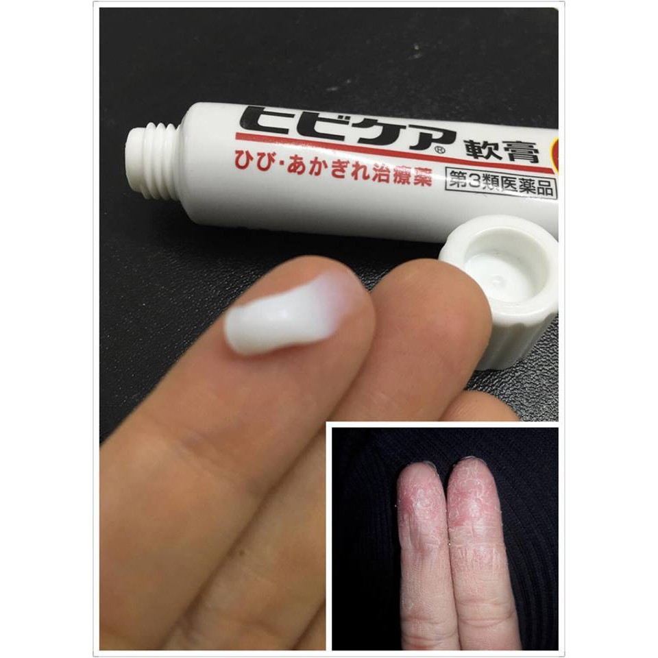 Kem dưỡng da tay trị nẻ Hibikea Muhi 35g