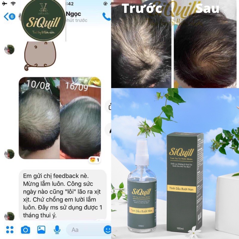 Xịt Mọc Tóc Tinh Dầu Bưởi Siquill ⚡𝑪𝒉𝒊́𝒏𝒉 𝑯𝒂̃𝒏𝒈 100%⚡ Mọc tóc nhanh giảm tình trạng hói sản phẩm thiên nhiên