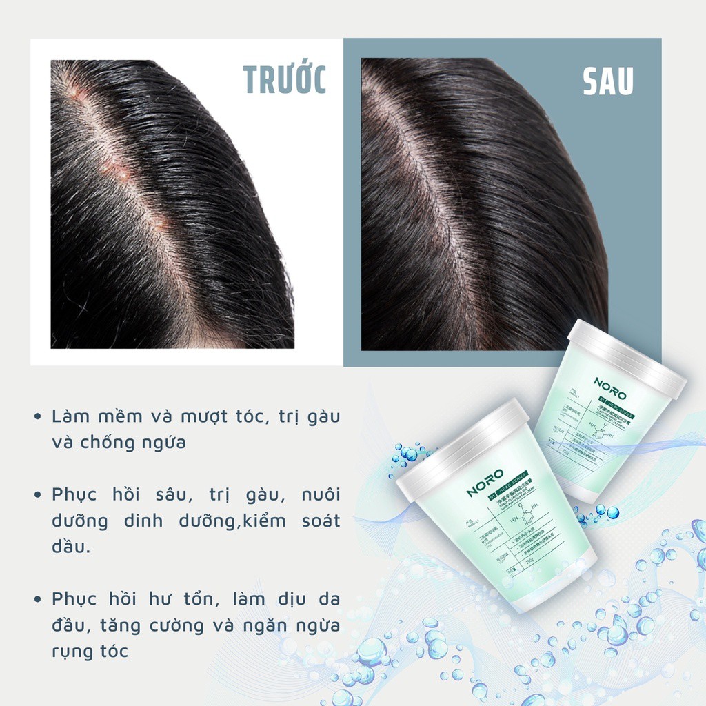 Tẩy da chết da đầu JIORNIEE kiểm soát dầu nhờn giảm bết tóc - Sarah Beaute MP38