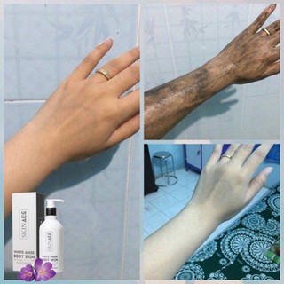 Sửa tắm kích trắng skin aec