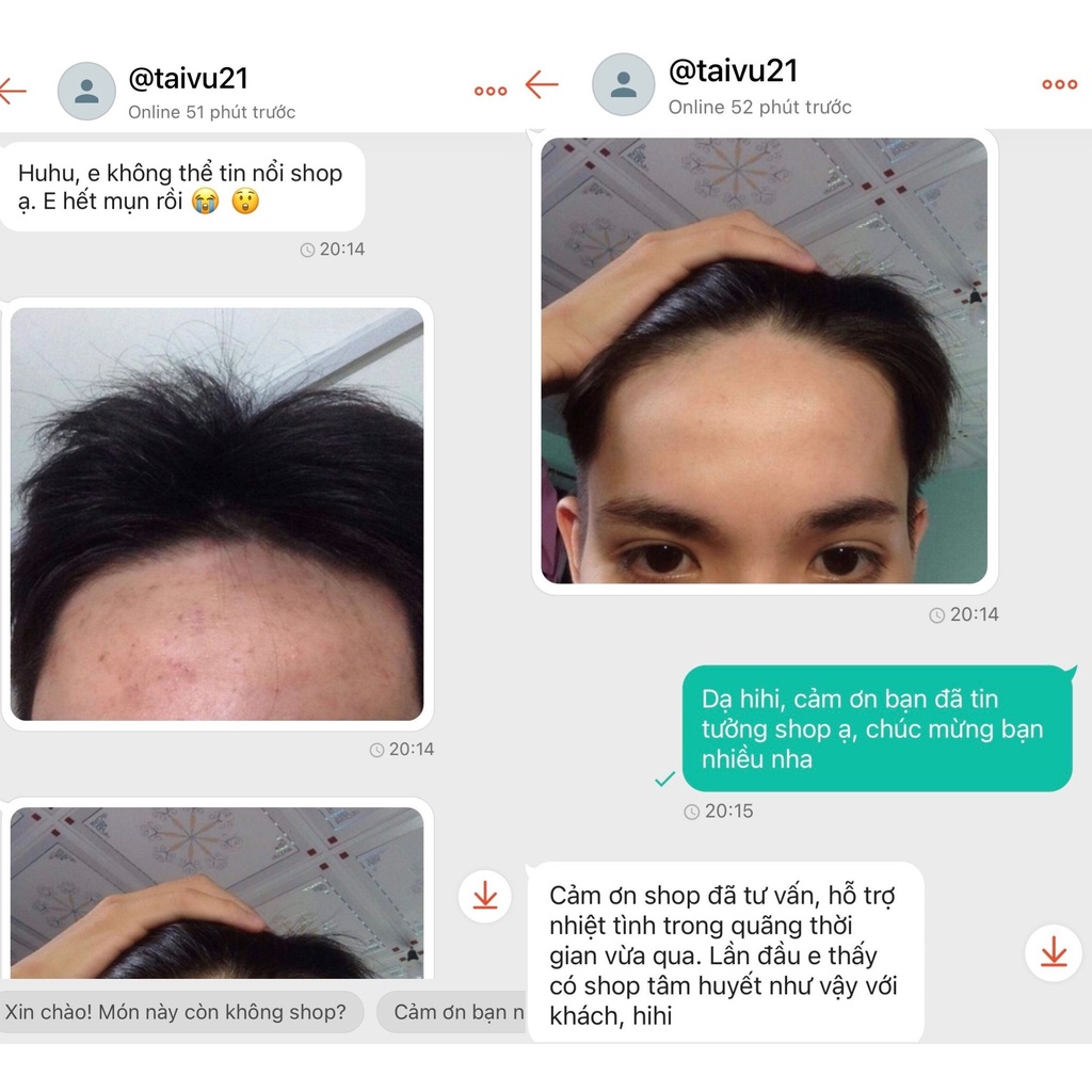 tái tạo da sắc mộc thiên - CHÍNH HÃNG MIỀN BẮC - Hỗ trợ giảm thâm mụn, nám, sẹo rỗ sau 1 liệu trình sử dụng | BigBuy360 - bigbuy360.vn