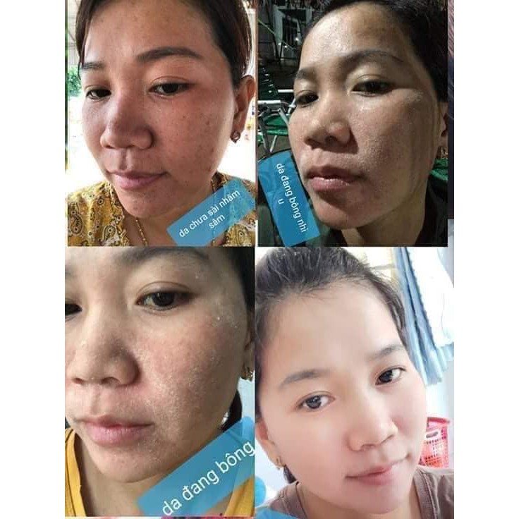 [HÀNG CHÍNH HÃNG] Serum nhân sâm tái tạo da MQ Skin 💗Freeship 💗 Tinh chất nhân sâm của Hàn Quốc | BigBuy360 - bigbuy360.vn