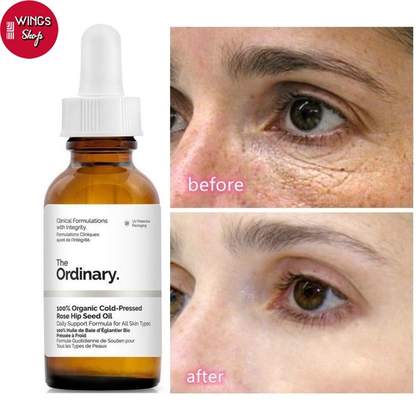 Tinh chất The Ordinary Caffeine 5% + EGCG Dưỡng ẩm Loại bỏ quầng thâm nếp nhăn và bọng mắt 30ML | Wings Shop