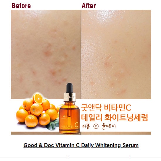 [ HÀNG CÔNG TY ] Serum Vitamin C Mờ Thâm Nám Trắng Da Goodndoc Vitamin C 16.5 Daily Whitening Serum 30ml