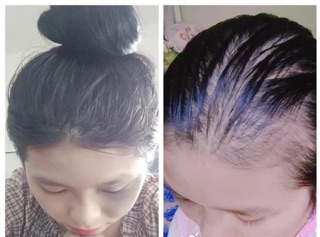 Tinh chất dầu gội thảo mộc Mẹ Ken