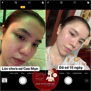 CAO MỤN SÂM ĐỎ
