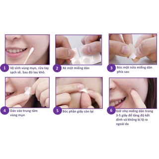 Miếng Dán Trị Mụn Cosrx Acne Pimple Master Patch