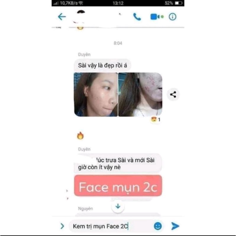 Kem Face Mụn Trắng Da 2c - Dưỡng Ẩm