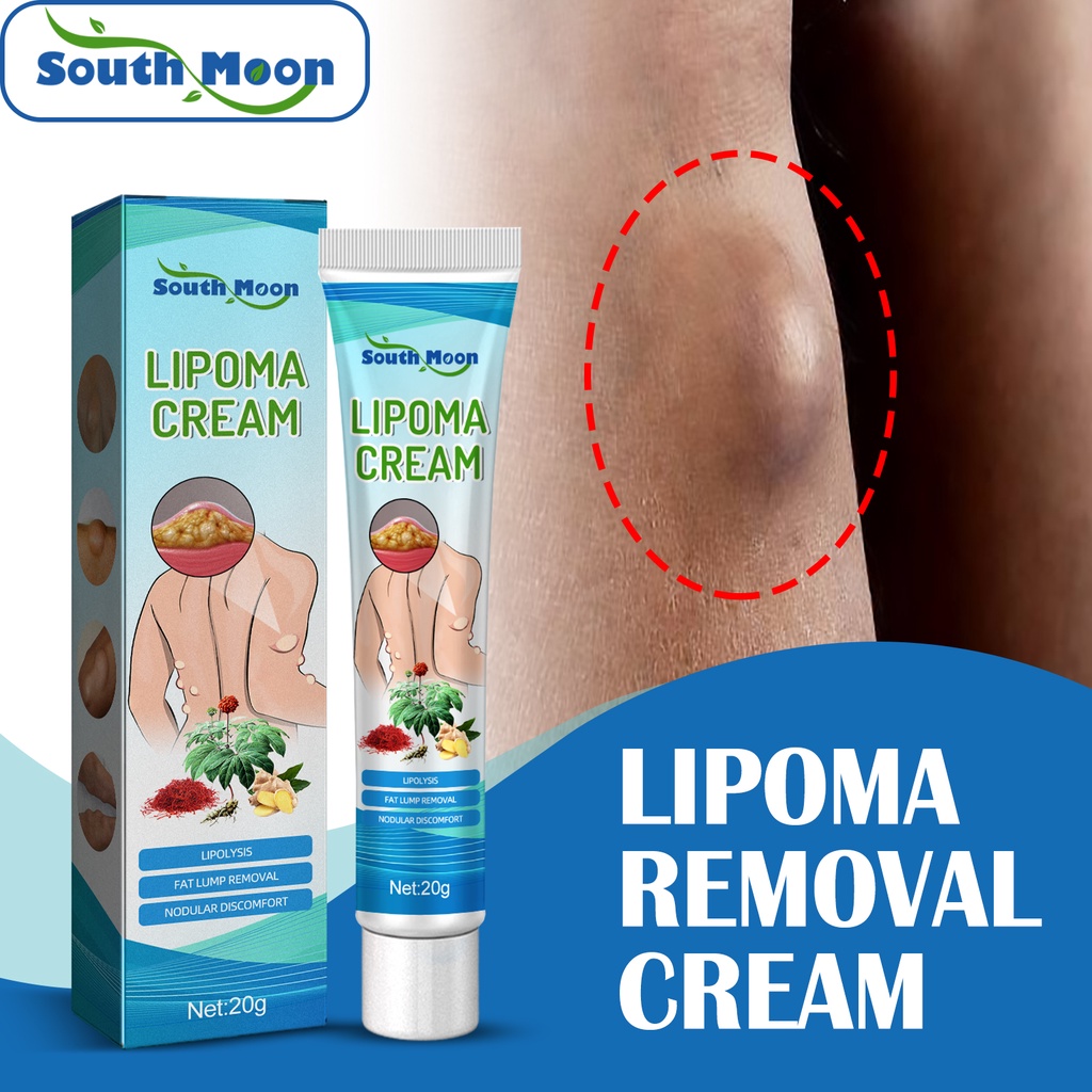 Đọc Chứng Khoán 1PC nam mặt trăng loại bỏ lipoma Kem lipolysis chất béo khối u cứu trợ thạch cao da sưng Thuốc mỡ thực vật tự nhiên chiết xuất chất béo [Top]