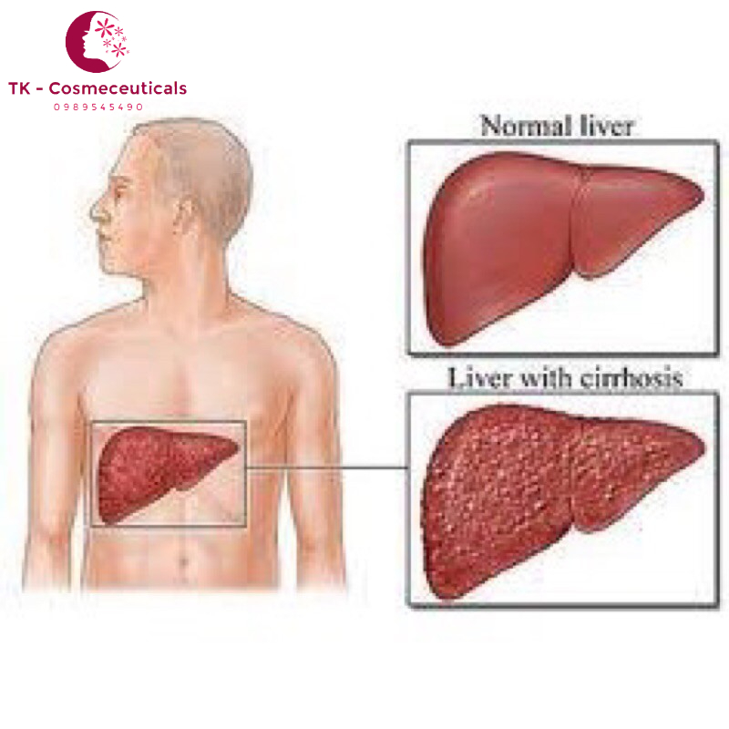 Boganic Lippi - giải độc gan, hạ mỡ máu - bảo vệ gan - Chính hãng Traphaco , Hộp 30 viên