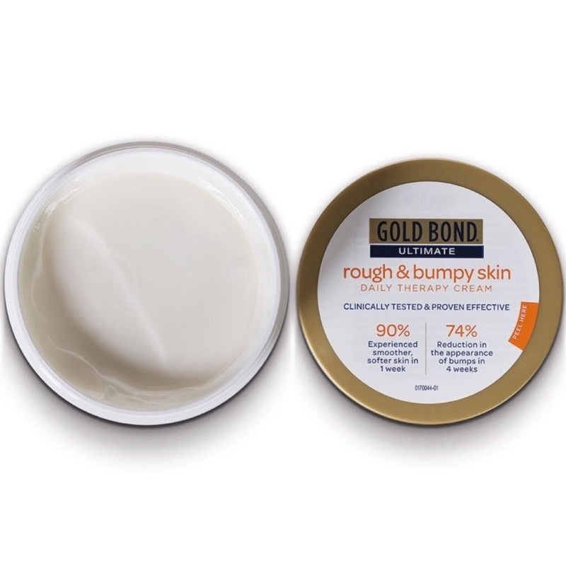 Kem dưỡng body gold bond rough and bumpy skin