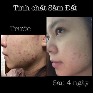 Tinh Chất Sâm Đất - Thảo Mộc Hàn