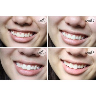 💎Kem đánh trắng răng CREST 3D WHITE - Mỹ💎