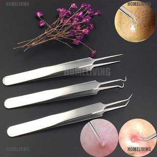 Nhíp Nặn Mụn Đầu Đen Bằng Thép Không Gỉ Tiện Dụng