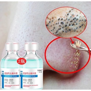 Combo 4 món skincare