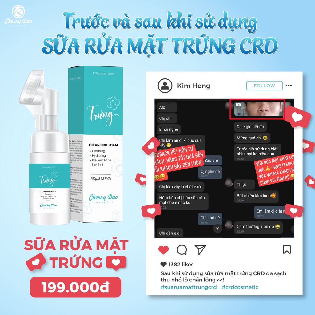 Sữa rửa mặt trứng CRD Cherry Đào dưỡng ẩm có đầu cọ Silicon tạo bọt làm sạch sâu 120Gr