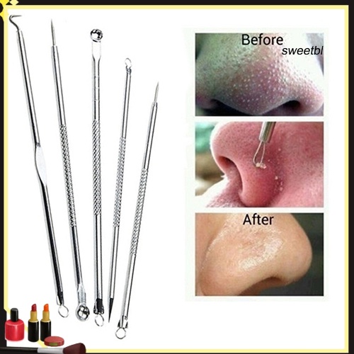Set 5 dụng cụ nặn mụn đầu đen chuyên nghiệp chất lượng cao