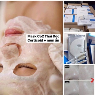 Combo Mặt nạ thải độc da CO2,10 miếng mặt nạ