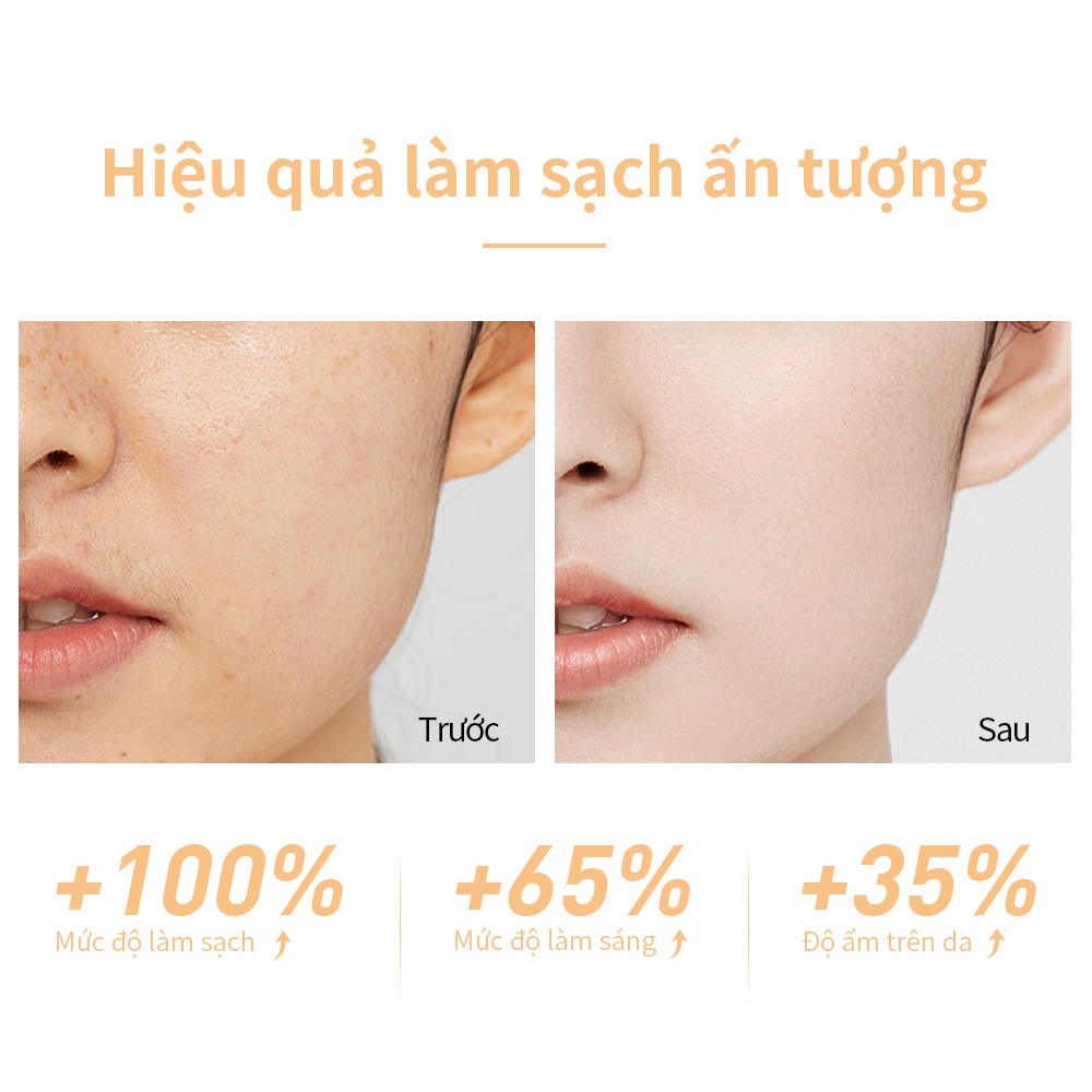 Sữa rửa mặt LANBENA Niacinamide Tạo Bọt Làm Sạch Sâu và trắng Sáng da dưỡng ẩm Làm Sạch 100ml