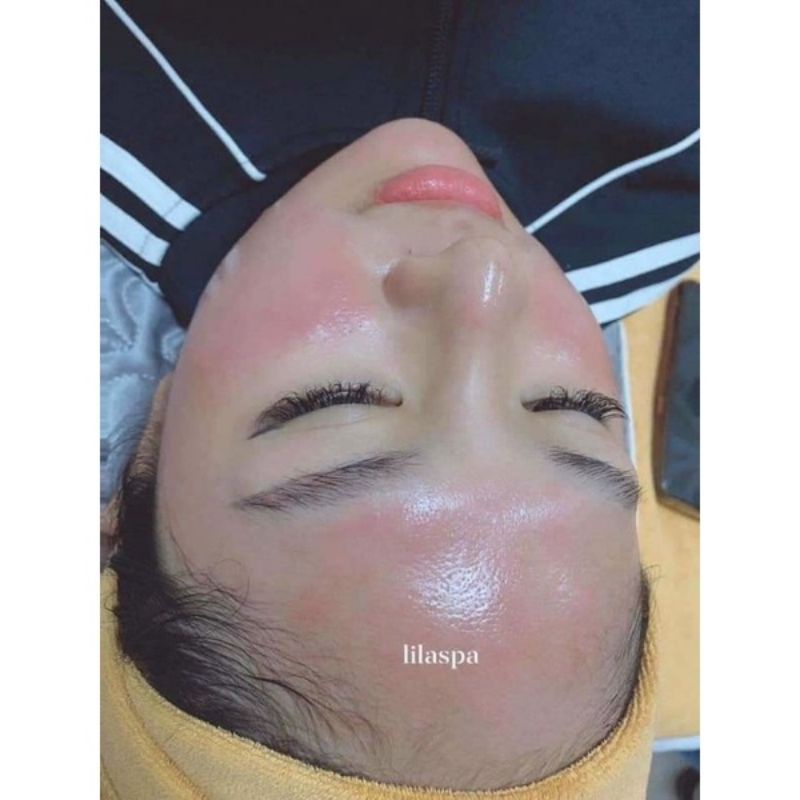 Tinh Chất Mulwang X5 Vàng Xịn, Mẫu Mới Nhất, Căng Bóng Trẻ Hóa Da Màu Vàng Chanh