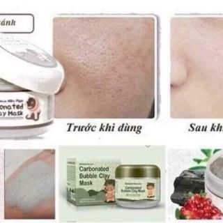Mặt Nạ Sủi Bọt Thải Độc Bioaqua MS081