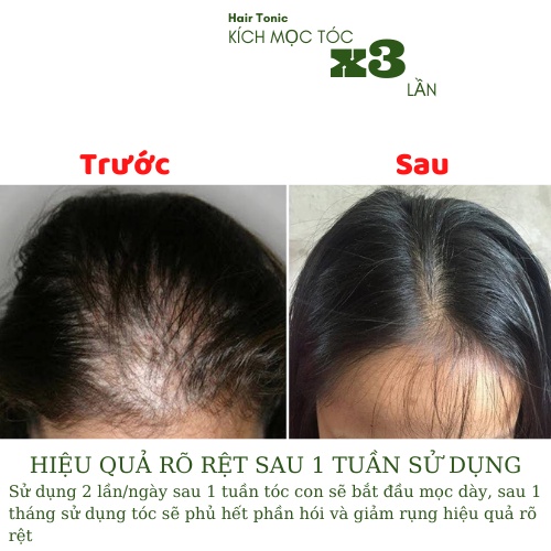 Xịt Mọc Tóc Vỏ Bưởi Hair Tonic Dung Tích 50ml, Kích Mọc Tóc Nhanh Gấp 3 Lần Sau 1 Tuần Sử Dụng