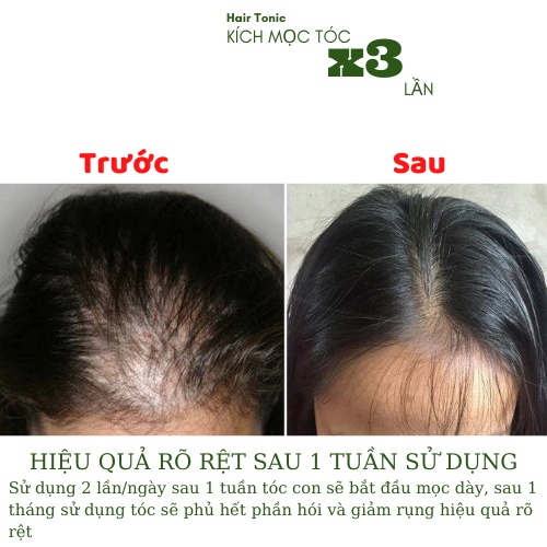 Xịt Mọc Tóc Vỏ Bưởi Hair Tonic Dung Tích 50ml, Kích Mọc Tóc Nhanh Gấp 3 Lần Sau 1 Tuần Sử Dụng