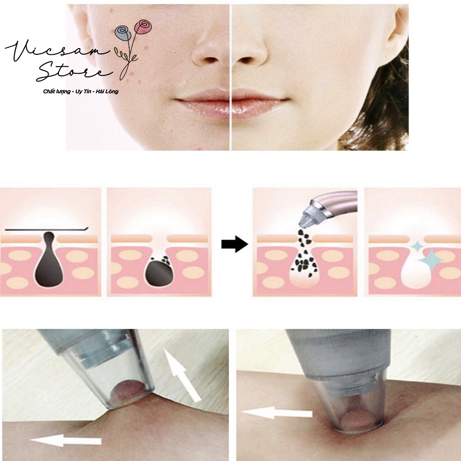 [Có Video Quay Thật] Máy Hút Mụn Đầu Đen ,Mụn Cám Comedo Suction Hàn Quốc Cầm Tay Dạng Sạc Tăng 2mặt nạ collagen 50k | BigBuy360 - bigbuy360.vn