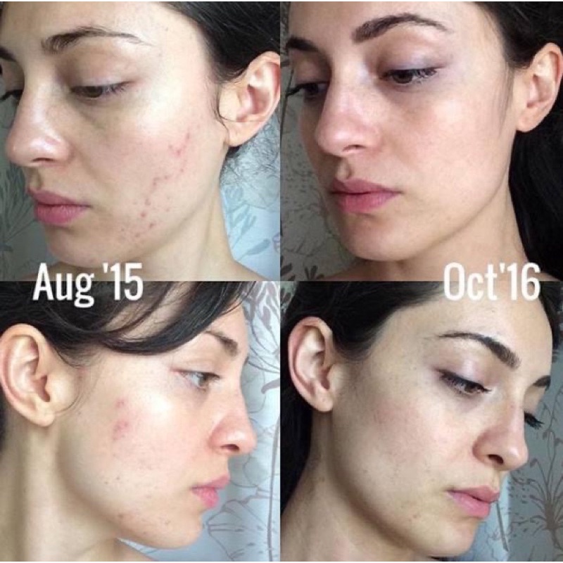 [TEM CÔNG TY] Serum Skinceuticals Phyto Corrective 30ml Giảm Kích Ứng, Giảm Đỏ Cho Da