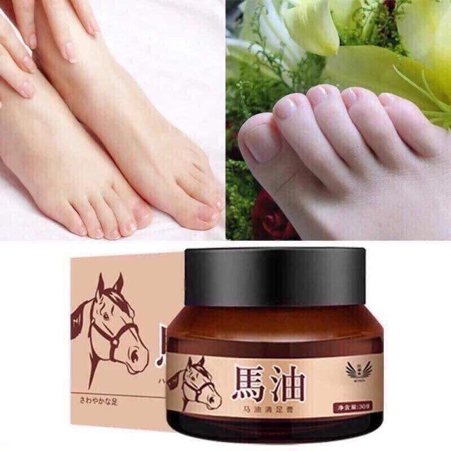 KEM DẦU NGỰA TRỊ NỨT NẺ GÓT CHÂN 30Gr