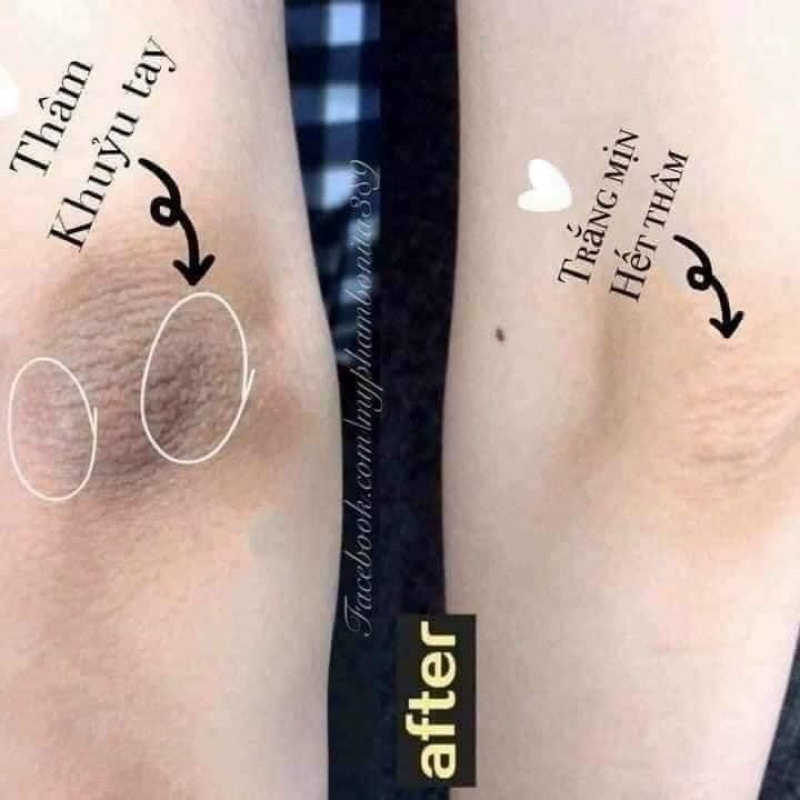 Kem Giảm Thâm Nách, Khử Hôi Nách  Giảm Thâm Đầu Gối, mông Skin Organic Secret White Thái Lan 50g