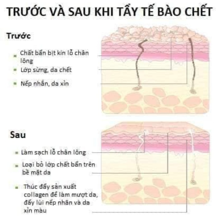 GEL TẨY DA CHẾT LÀM SẠCH TẾ BÀO GIÀ TRẺ HÓA DA [CHÍNH HÃNG]