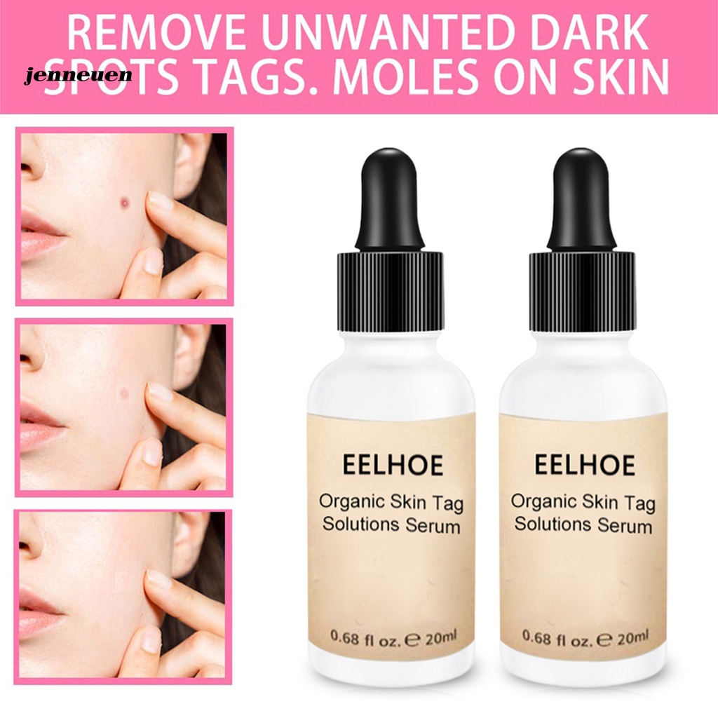 [Hàng mới về] Serum Loại Bỏ Mụn Thịt Dịu Nhẹ Không Gây Kích Ứng Cho Nữ