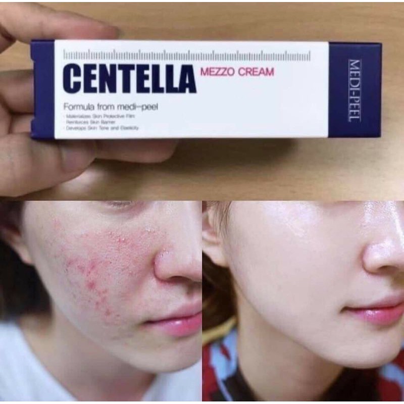 Kem Giảm Mụn Centella Medi Peel Hàn Quốc