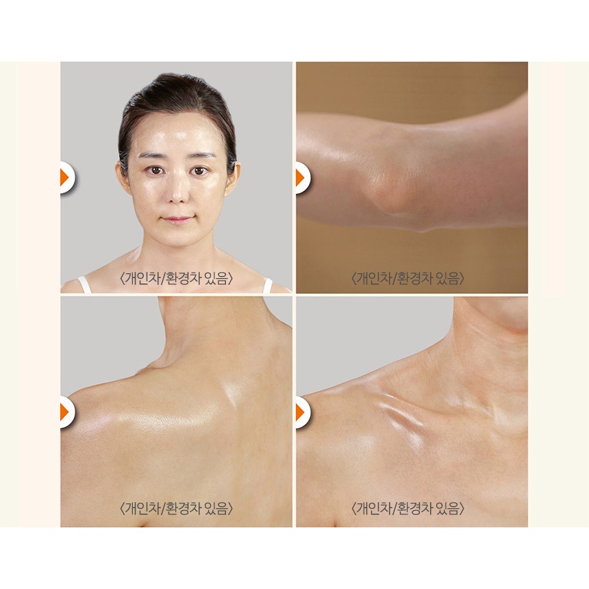 Gel tắm tẩy tế bào chết Piteroma UCG Hàn Quốc 200ml | BigBuy360 - bigbuy360.vn