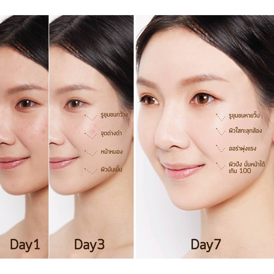 Serum se khít lỗ chân lông hãng Best Korea 10ml