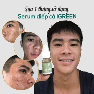 Bộ đôi thần thánh serum diếp cá + sữa rửa mặt igreen
