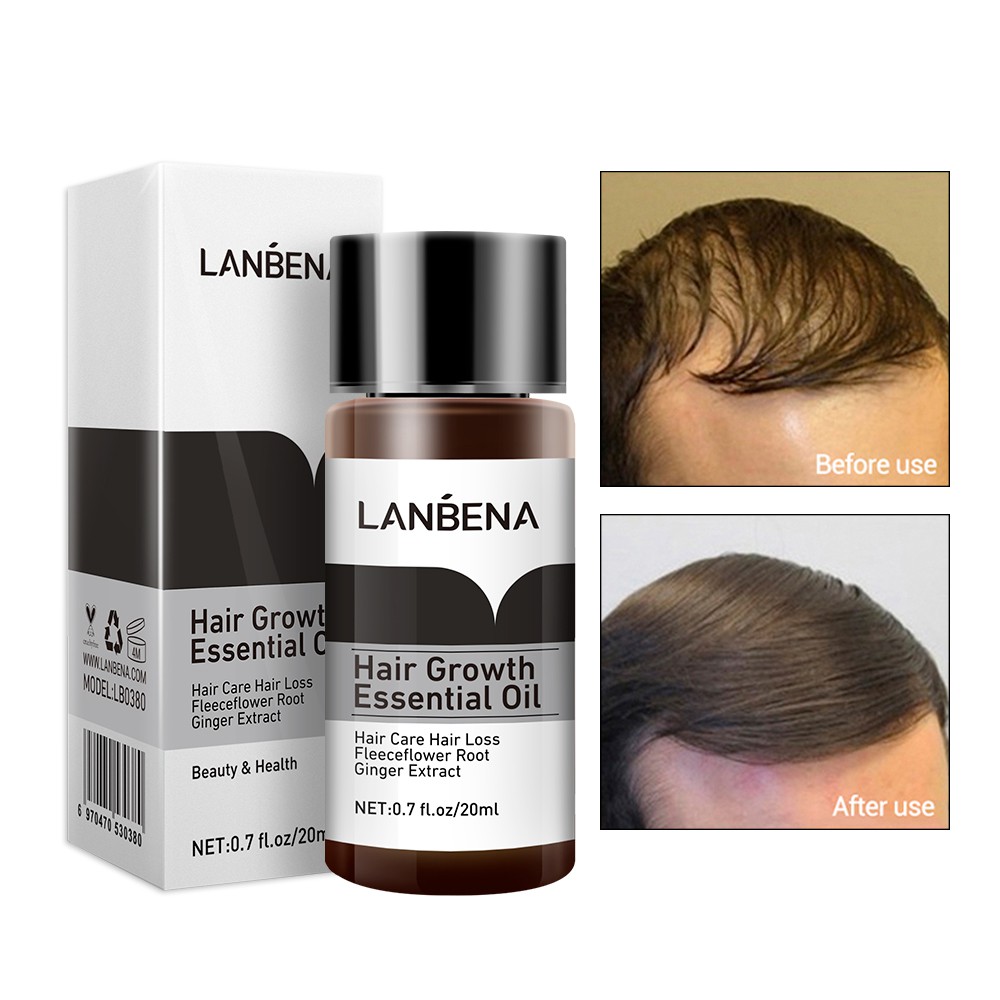 Tinh chất LANBENA giúp mọc tóc dưỡng ẩm cho da đầu