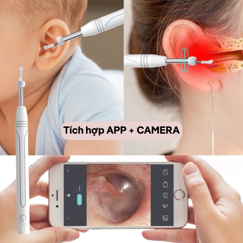 Camera nội soi KAW kết nối với wifi, soi tai mũi họng dùng được cho các loại điện thoại
