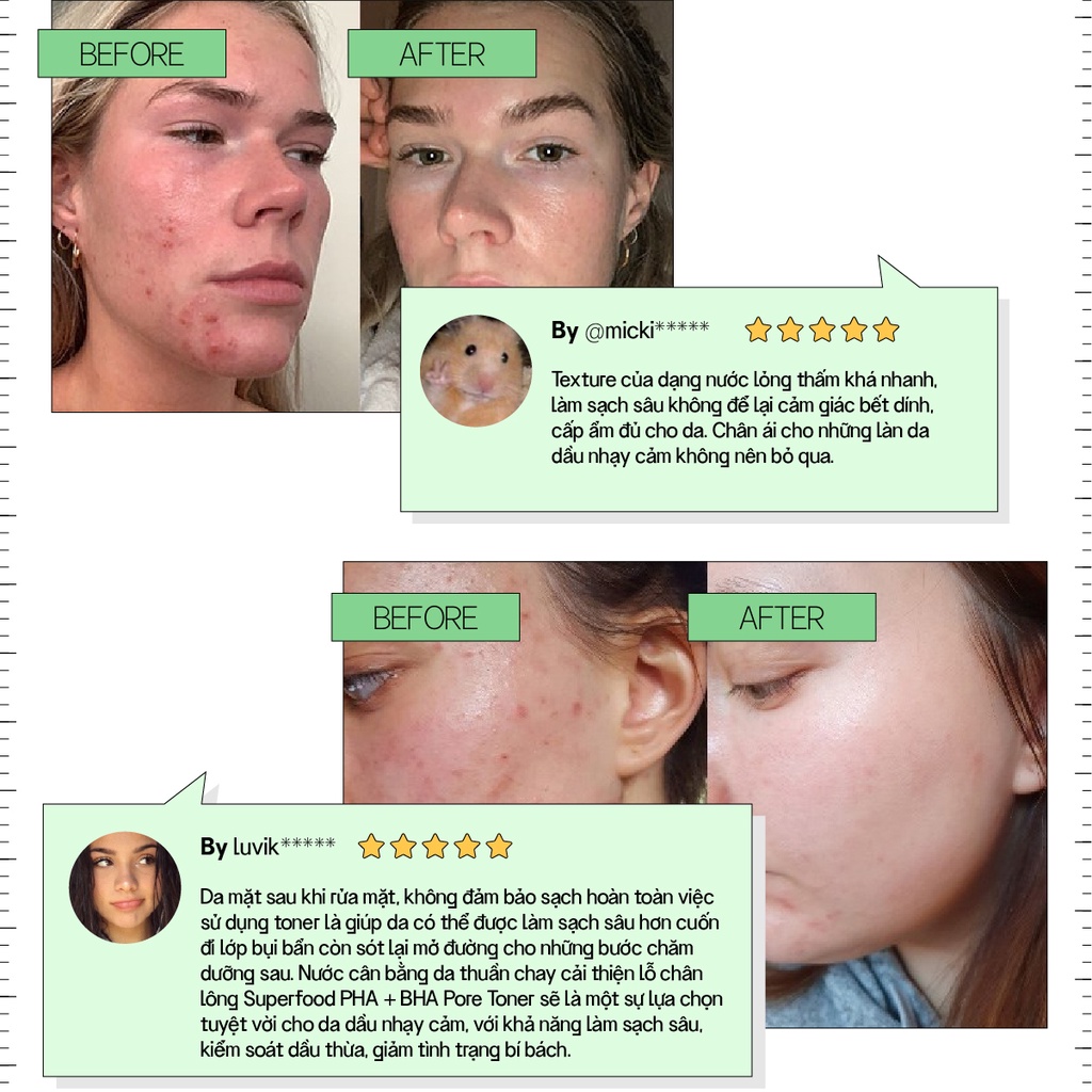 Toner Vegick Thuần Chay Cải Thiện Lỗ Chân Lông 210ml Superfood PHA + BHA Pore Toner