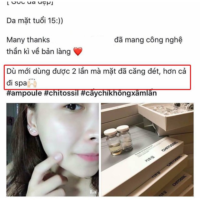 SET CHỈ CẤY TƠ TẰM CHITOSSIL AMPOULE