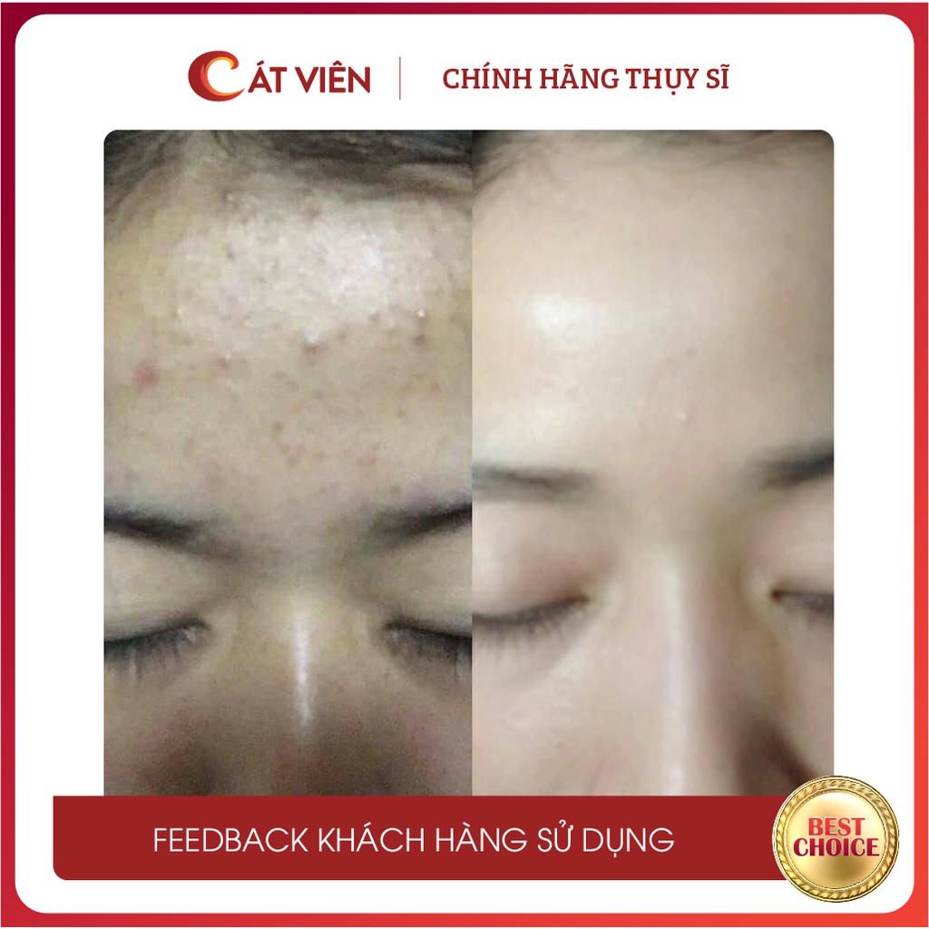 Tinh chất chấm mụn Derma Me'Dream, se mụn, giảm kích ứng, giảm thâm mụn, dưỡng ẩm, dưỡng trắng và se khít lỗ chân lông