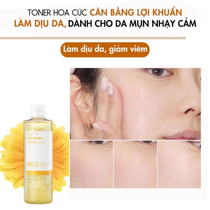 Toner Hoa Cúc Cân Bằng Lợi Khuẩn, Làm Dịu Da, Siêu Cấp Ẩm Cho Da Mụn Nhạy Cảm Neogen Dermalogy 300ml