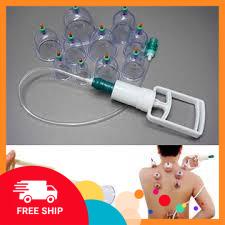 [FREE SHIP] Bộ giác hơi không dùng lửa 10 ly