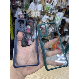 Ốp lưng Xiaomi Redmi Note 11S / Note 11 4G