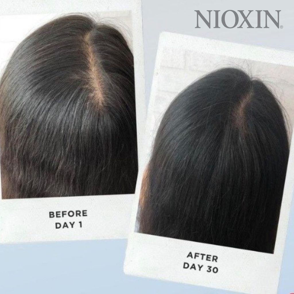 Dầu Xả NIOXIN 2 Dành Cho Tóc Tự Nhiên, Thưa Mỏng Và Rụng Nhiều Trong Thời Gian Dài Scalp Conditioner Natural Hair 1000ml