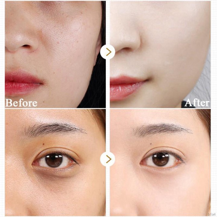 Serum Dưỡng Da Mặt Dạng Viên Trắng Hồng Dưỡng Ẩm Tinh Chất Cá Hồi | BigBuy360 - bigbuy360.vn