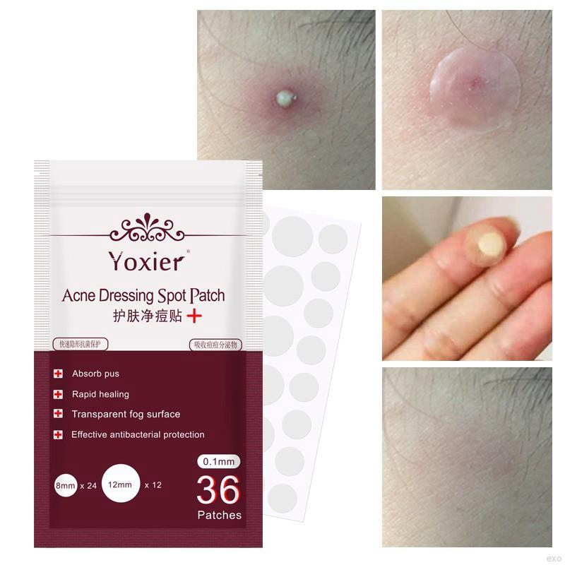 Face Patch Gel Patch Face Skin Care | BigBuy360 - bigbuy360.vn