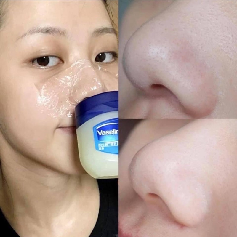 Sáp dưỡng đa năng Vaseline bản Hàn (đủ bill - chính hãng)