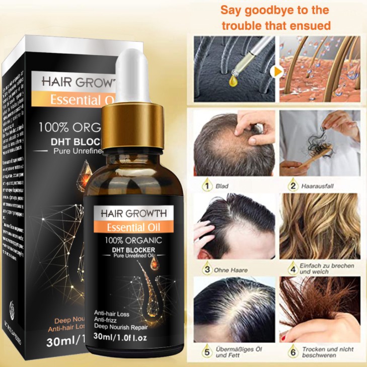 Tinh dầu gừng chăm sóc tóc chắc khỏe Hair Growth Essential Oil 30ml